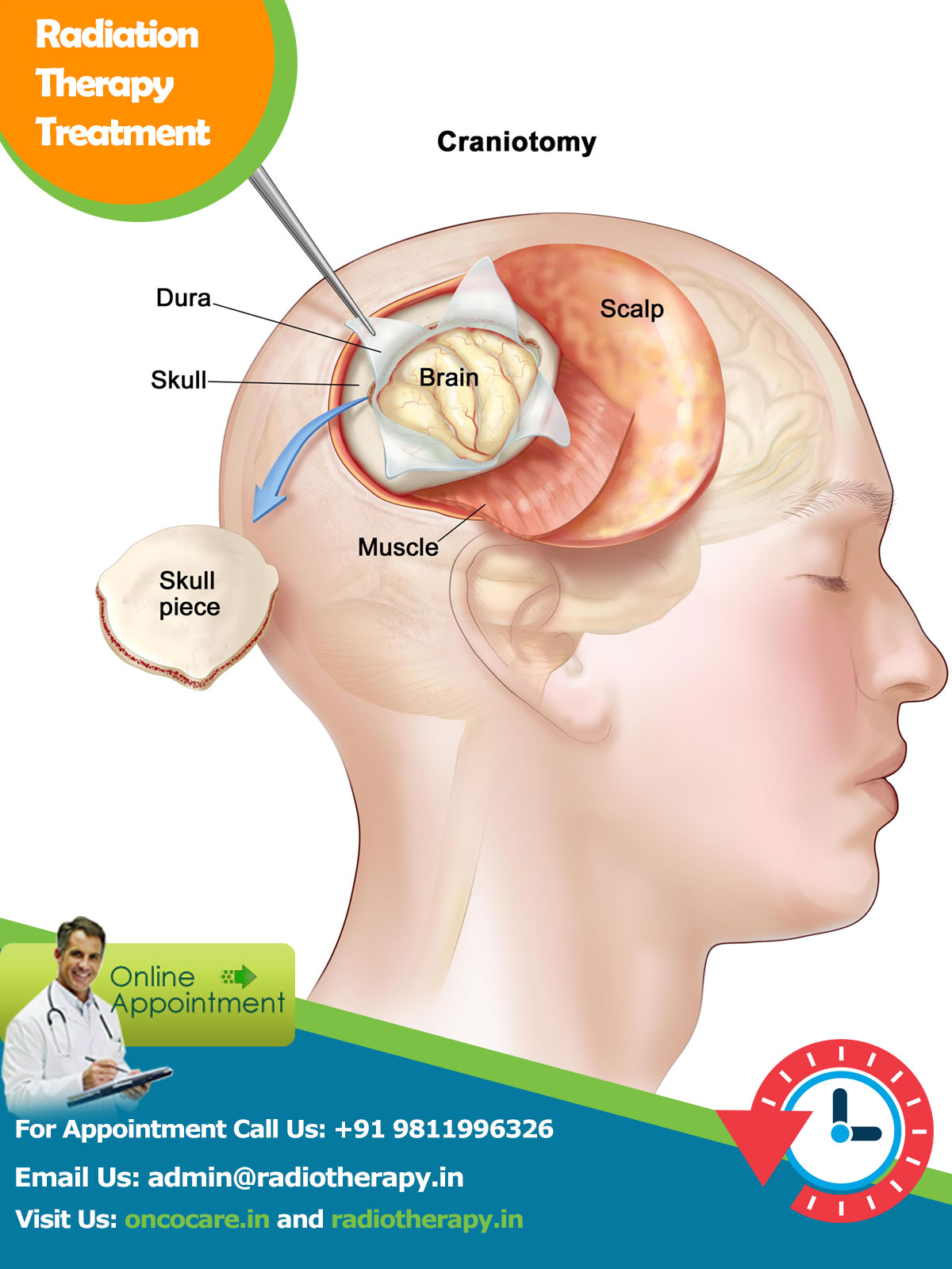 brain tumors treatment