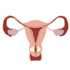 Cervix Cancer Treatment India
