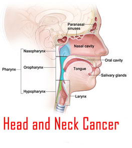 Head Neck Cancer