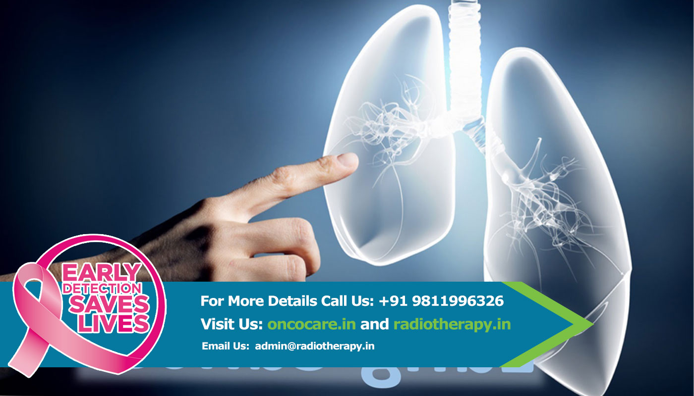 lung cancer Treatment in India