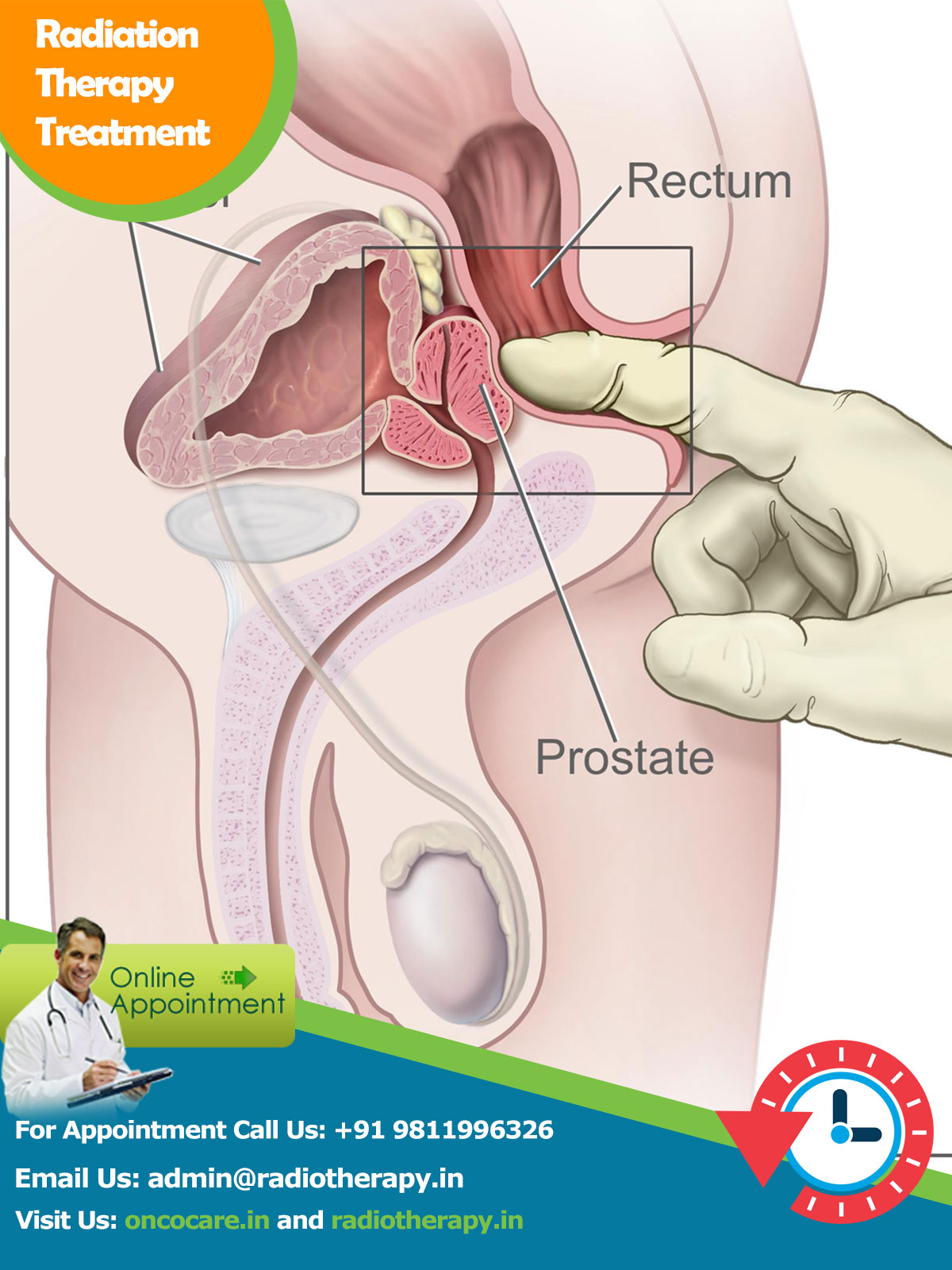 Prostate Cancer Treatment in Delhi